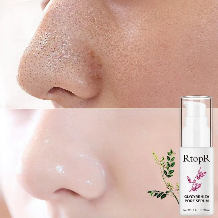 Pore Shrinking Essence Face Repair Essential Oil Repairing Shrinking Pores Whitening Moisturizing Remove  Blackheads Face Care
